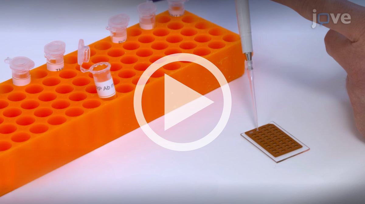 New JoVE Video: Rapid Topoisomerase 1 Activity Detection in Biological Samples Using Rolling Circle Amplification